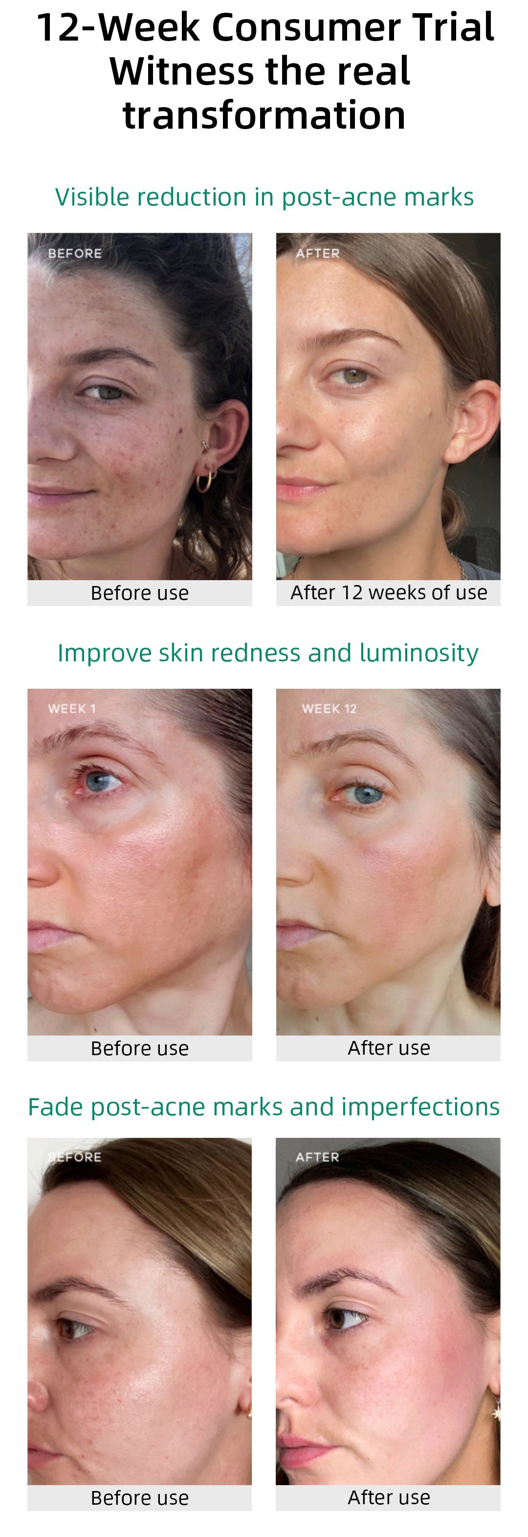 Vida Glow Radiance Capsules